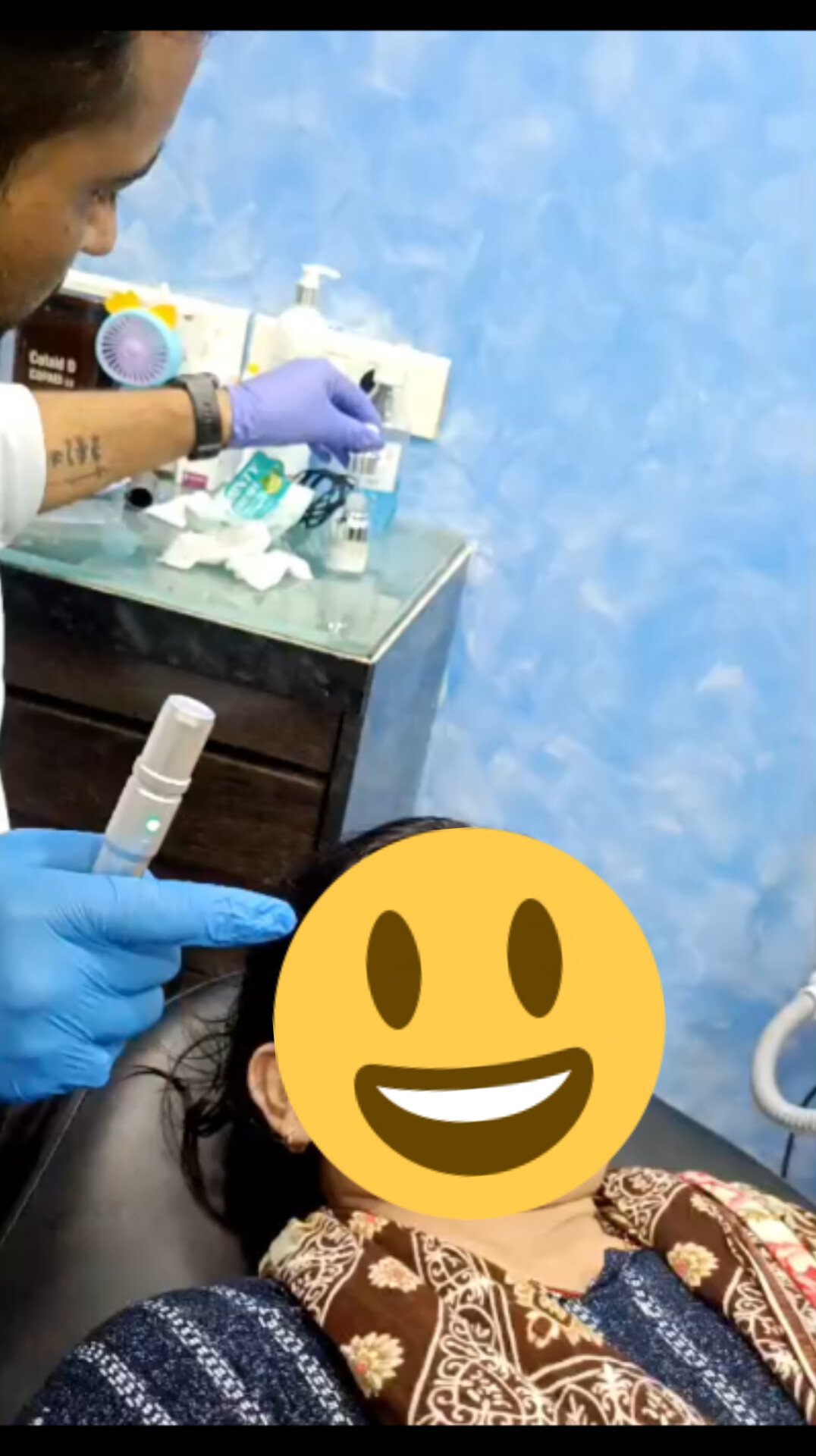 Micro needling/Subcison/ Acne scar treatment